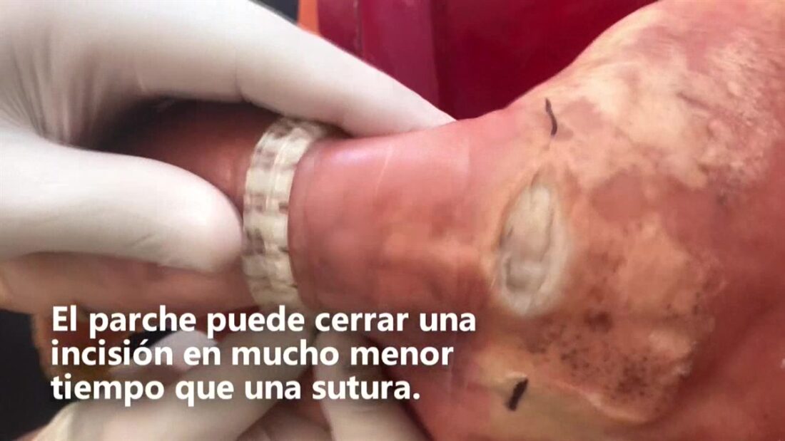 Más allá del domingo: heridas del cirujano